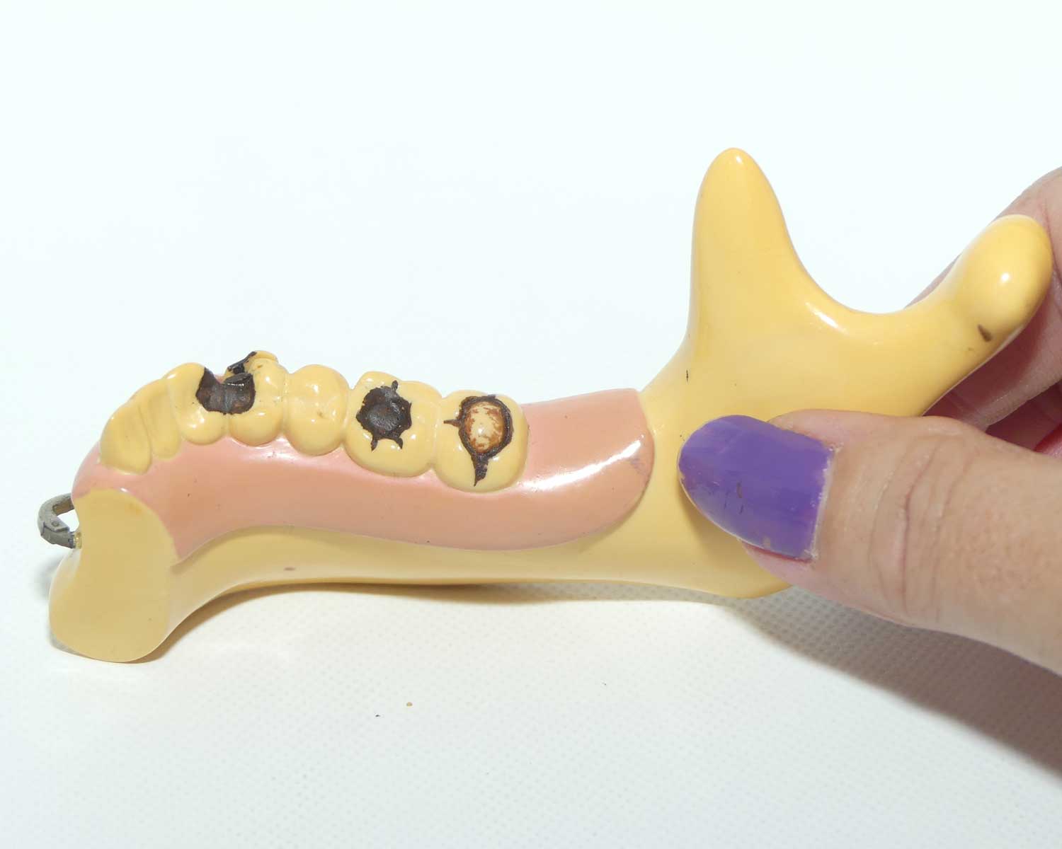 DeDentist's Educational Display Mandible | Object Of Curiosity | made from Galalith or Bakelitentist's Educational Display Mandible | Object Of Curiosity | made from Galalith or Bakelite