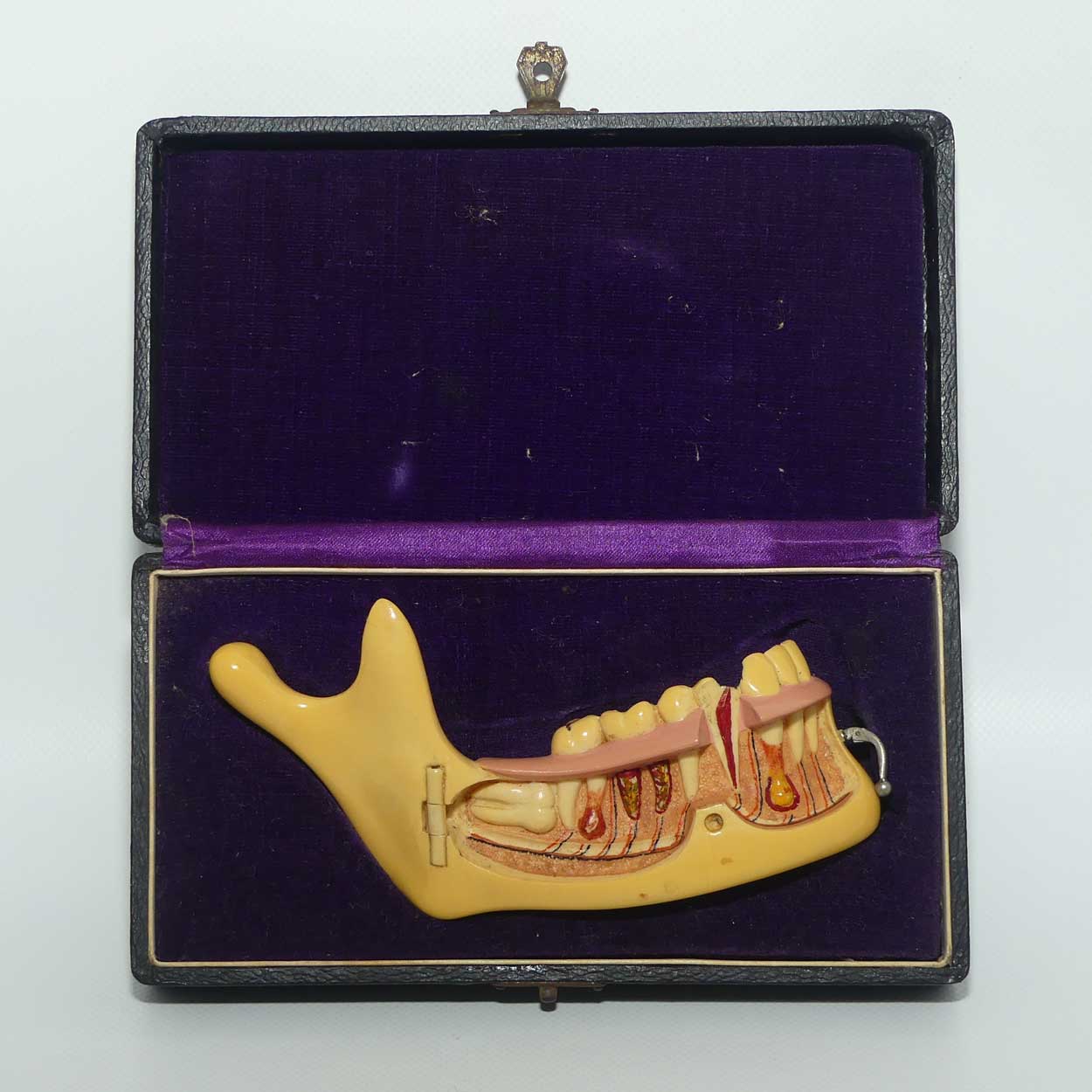 Dentist's Educational Display Mandible | Object Of Curiosity | made from Galalith or Bakelite