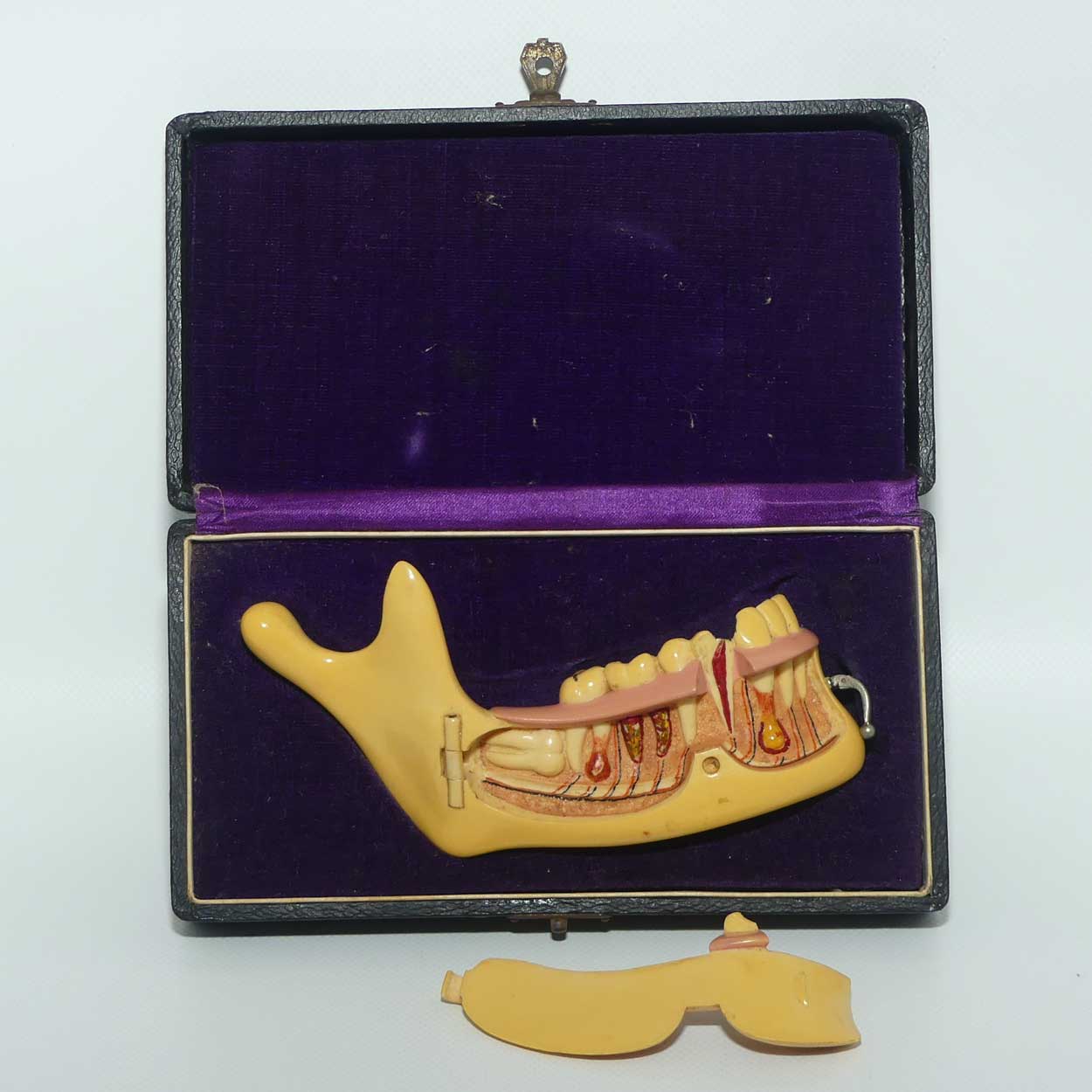 Dentist's Educational Display Mandible | Object Of Curiosity | made from Galalith or Bakelite